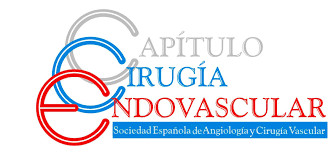 CONVOCATORIA DE PRENSA: Campaña informativa sobre las patologías vasculares y su tratamiento con técnicas endovasculares (sin cirugía abierta) CONVOCATORIA DE PRENSA: Campaña informativa sobre las patologías vasculares y su tratamiento con técnicas endovasculares (sin cirugía abierta)