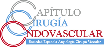 Un estudio arroja resultados favorables sobre la cirugía a través de catéteres de los aneurismas de arteria poplítea Un estudio arroja resultados favorables sobre la cirugía a través de catéteres de los aneurismas de arteria poplítea