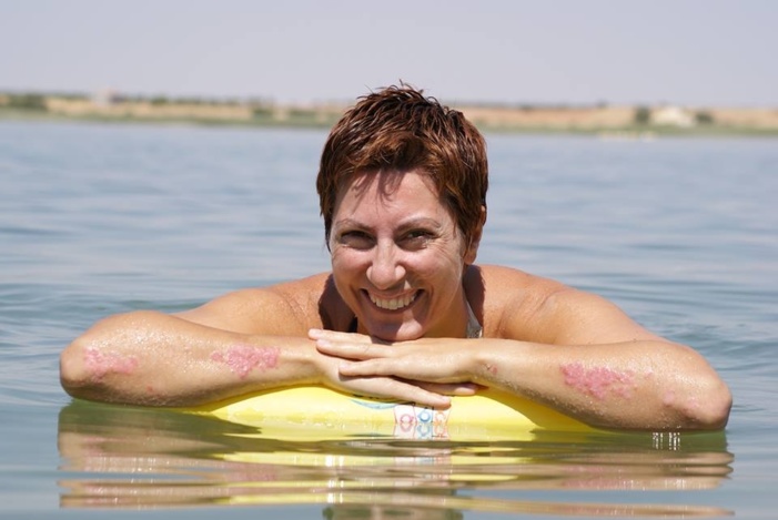 Las 229 farmacias de Huelva y provincia, puntos de apoyo y formación a pacientes y familiares afectados por psoriasis Las 229 farmacias de Huelva y provincia, puntos de apoyo y formación a pacientes y familiares afectados por psoriasis