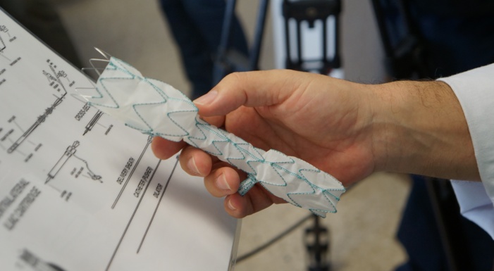 NOTA DE PRENSA: Cirugía endovascular de 'alta costura' y a 'medida' del paciente, desde el Hospital San Cecilio de Granada NOTA DE PRENSA: Cirugía endovascular de 'alta costura' y a 'medida' del paciente, desde el Hospital San Cecilio de Granada