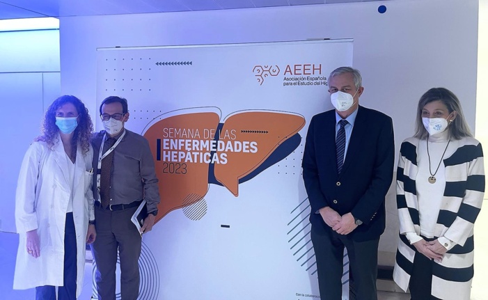 El carcinoma hepatocelular, el cáncer de hígado más frecuente, sigue en aumento por la creciente prevalencia del hígado graso y el consumo perjudicial de alcohol El carcinoma hepatocelular, el cáncer de hígado más frecuente, sigue en aumento por la creciente prevalencia del hígado graso y el consumo perjudicial de alcohol