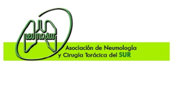 La sobrecarga media asistencial de los servicios de neumología de los hospitales andaluces alcanza el 56% de media, con máximos que llegan al 133%