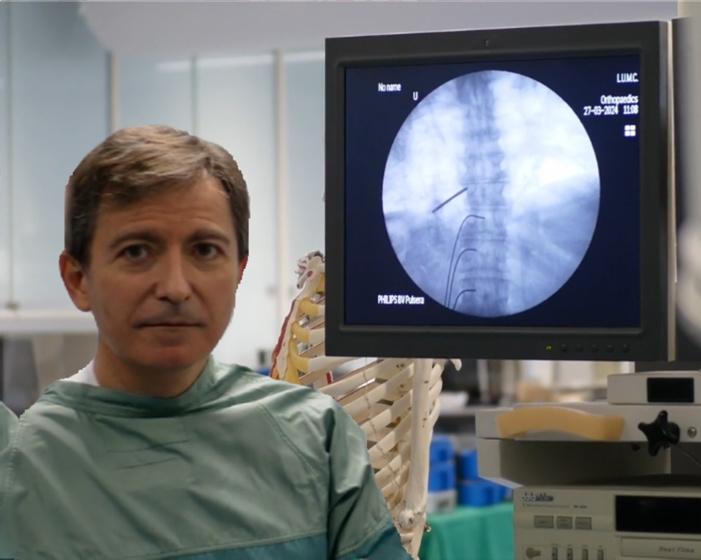 Los pacientes con fibromialgia responden peor al tratamiento por infiltración del dolor lumbar crónico frente a aquellos que no padecen esta patología Los pacientes con fibromialgia responden peor al tratamiento por infiltración del dolor lumbar crónico frente a aquellos que no padecen esta patología