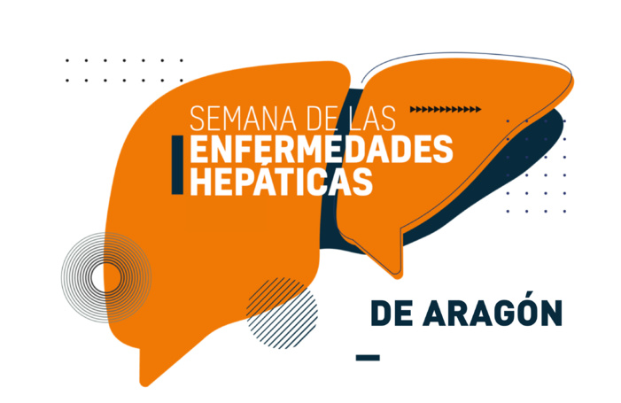 Nota de Prensa- Aragón celebra la Semana de las Enfermedades Hepáticas para concienciar sobre la importancia de la detección y el tratamiento precoz  ante el aumento de las patologías del hígado