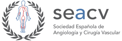 Personas con diabetes presentan un menor riesgo de sufrir un aneurisma de aorta abdominal según recoge un estudio