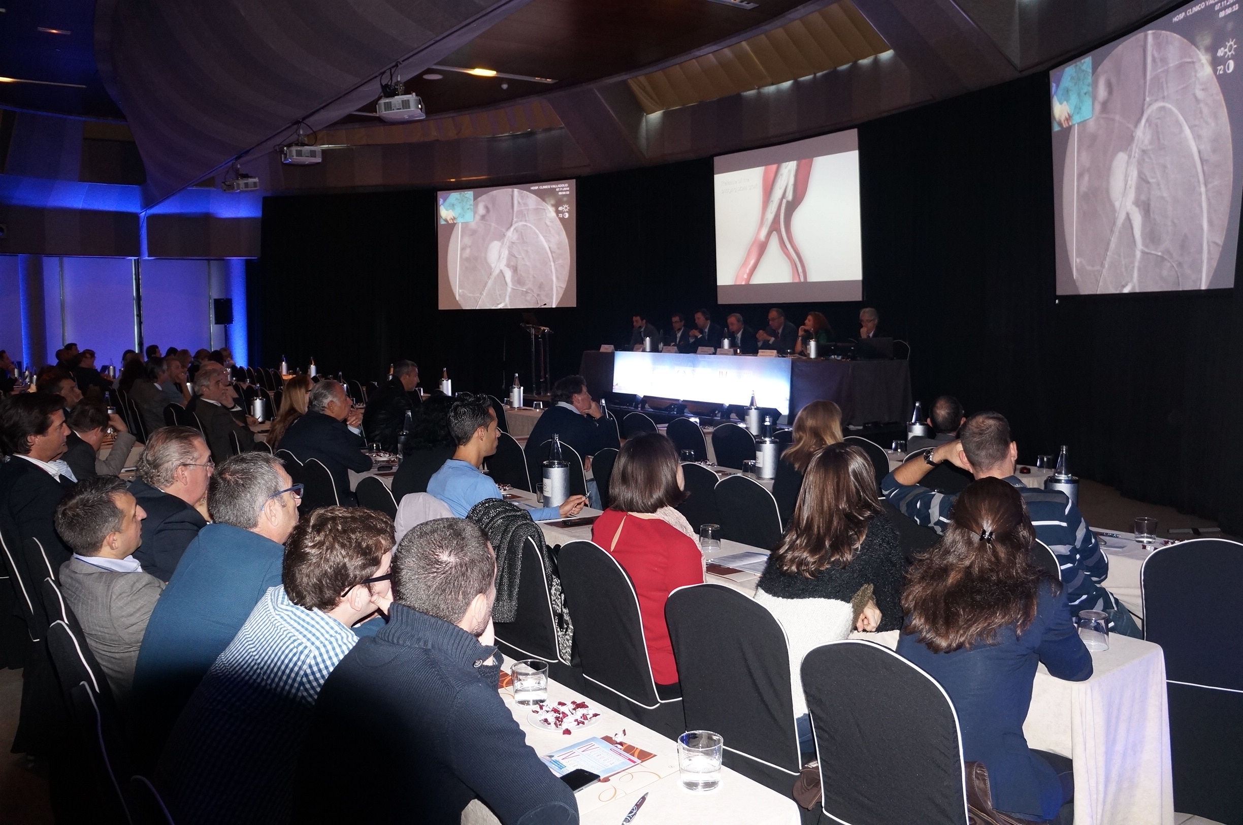 El Hospital Universitario de Valladolid retransmite en directo dos intervenciones practicadas con cirugía endovascular en el principal encuentro nacional de esta especialidad médica