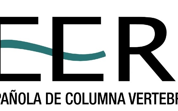 Nota de Prensa (Día Mundial)- El dolor lumbar prolongado sin causa aparente en una persona joven, motivo de sospecha de poder padecer espondilitis anquilosante